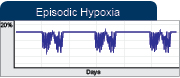 oxycylera84xov07